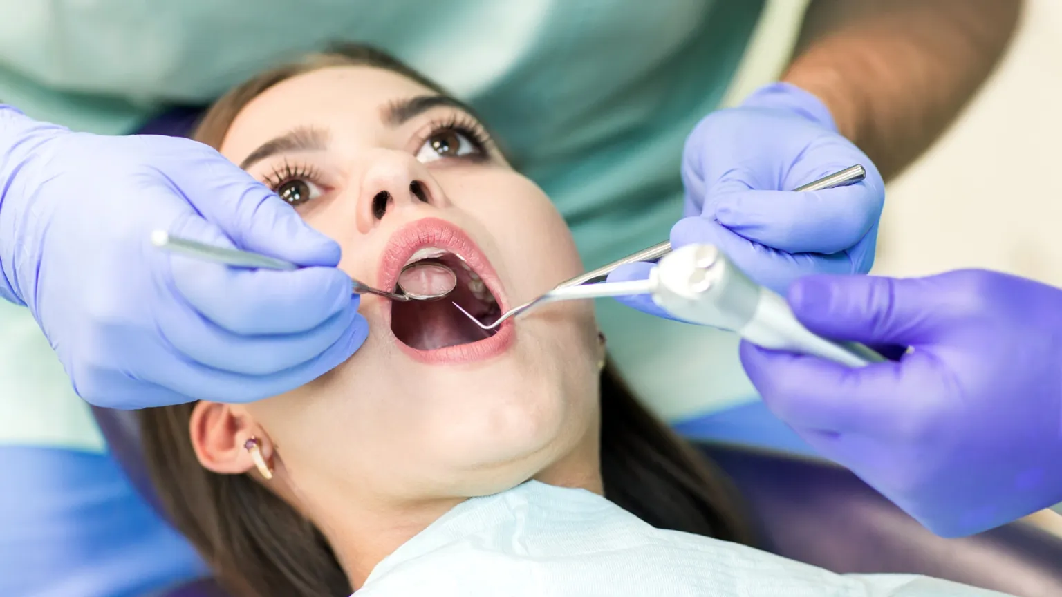 Root Canal Treatment